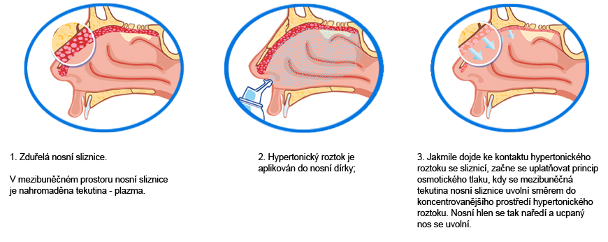 SCHEMA-OSMOSE-CZ